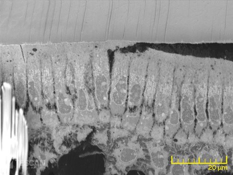 a-subcellular-05-v.jpg